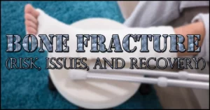 Bone fracture: Risk, Issues, and Recovery