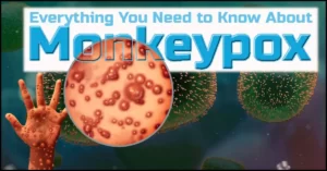 Monkeypox (Mpox) : Overview & Diagnosis